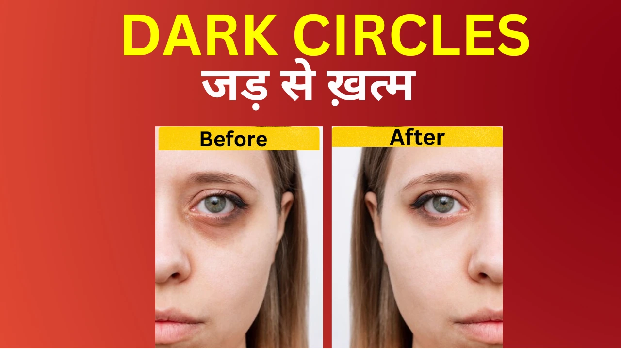 Tips to remove dark circles